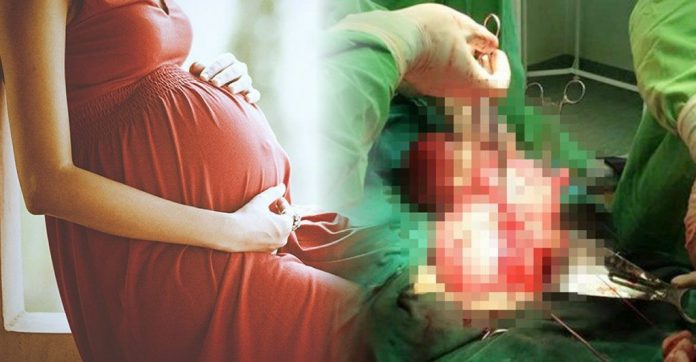 VIŅA DOMĀJA, KA IR STĀVOKLĪ, BET ĀRSTI ATKLĀJA KO ŠOKĒJOŠU! 1