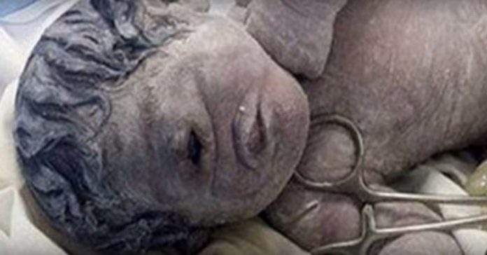 Šoks! Baisi un sāpīgi - Ēģiptē pasaulē nācis mazulītis-ciklops! 