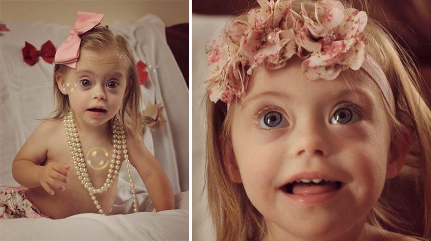 Šī divgadīgā meitenīte ar dauna sindromu ir ļoti populāra bērnu modele 1
