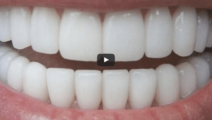 Bez nosaukuma Baltāki zobi tikai 3 minūtēs - neizejot no mājas