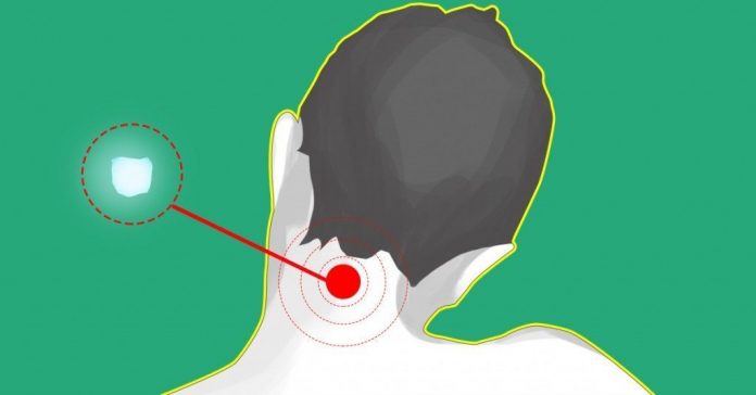 Lielisks atveseļošanās veids! Liekot ledu pie skausta var atbrīvoties no neskaitāmām kaitēm 1