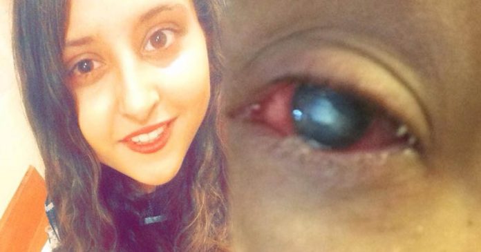 Šausminoši! Sieviete 4 diennaktis spiesta palikt nomodā dēļ acis ēdošajām vabolēm 