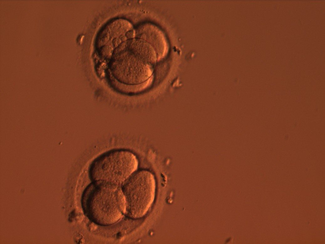 EGV klīnikas laboratorijā embriologu uzņemta medicīniski apaugļota embriju olšūna otrajā dienā.